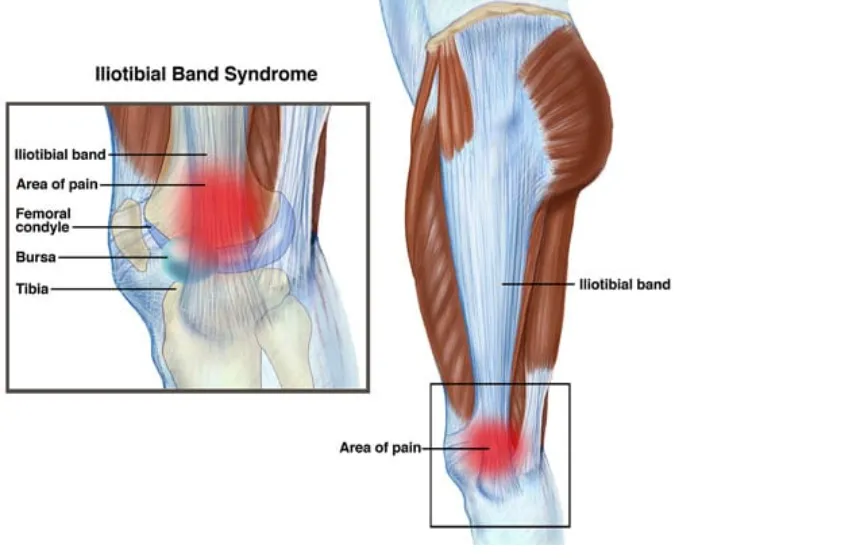 Correr asfalto imagen 2